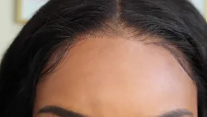 Close-up of a lace front wig showing the natural hairline